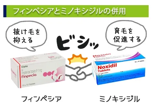 フィンペシアとミノキシジルの併用