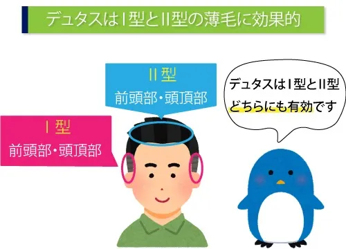 デュタスはⅠ型とⅡ型の薄毛に効果的
