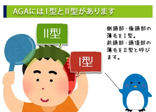 AGAにはⅠ型とⅡ型があります