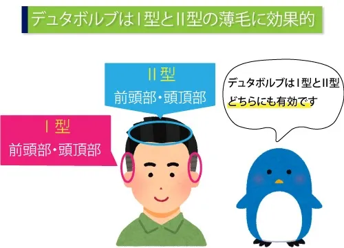 デュタボルブはI型とII型の薄毛に効果的