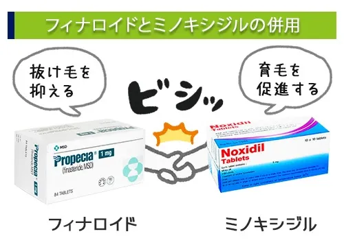 フィナロイドのミノキシジルの併用